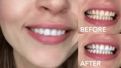 Pasta Blanqueadora Teeth Whitening
